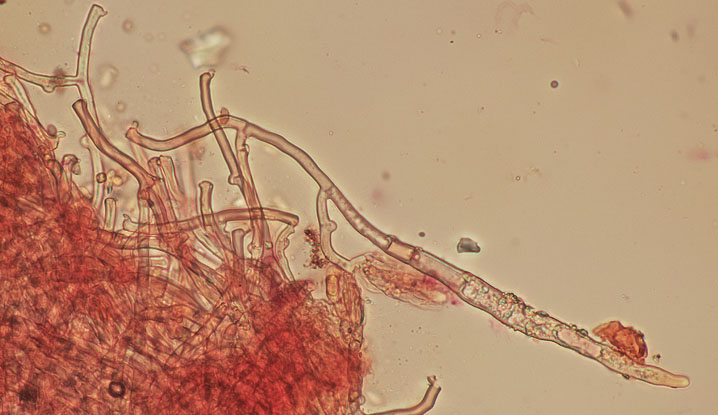 Hyphoderma setigerum